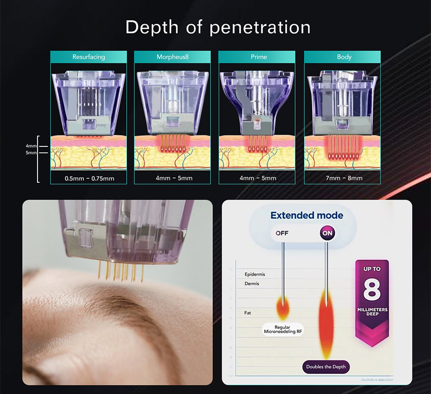 Портативный радиочастотный микроигольный аппарат Morpheus 8(图2)